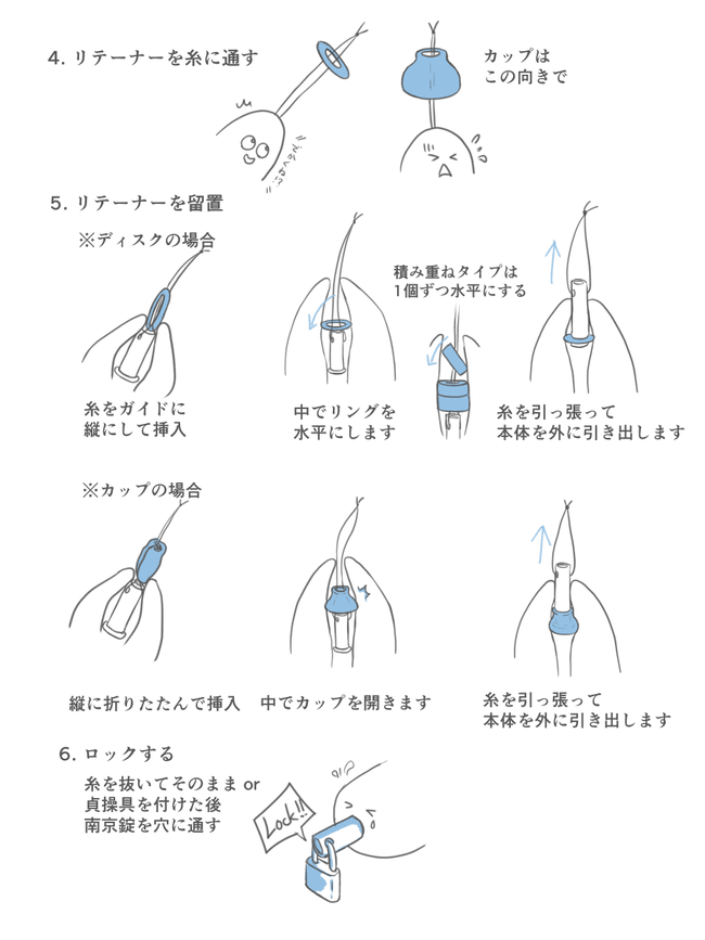 尿道テザー挿入方法2